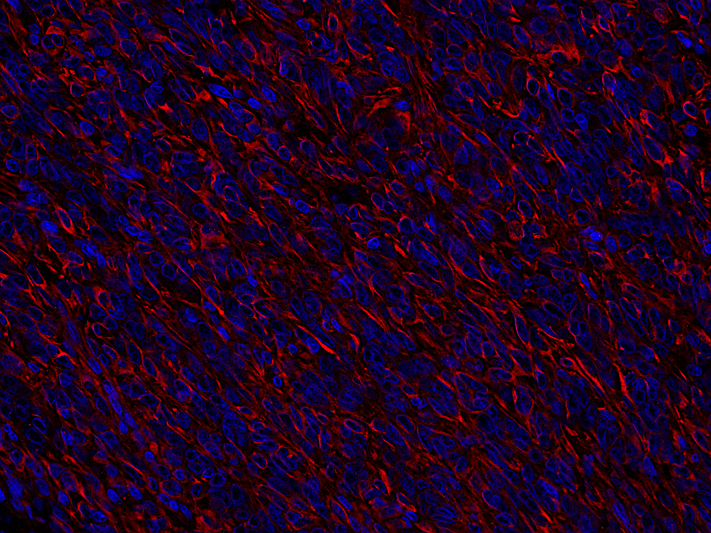 Vimentin Polyclonal rabbit antiserum - image 4