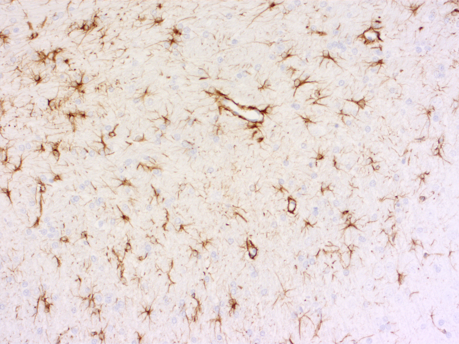 GFAP, Recombinant rabbit
