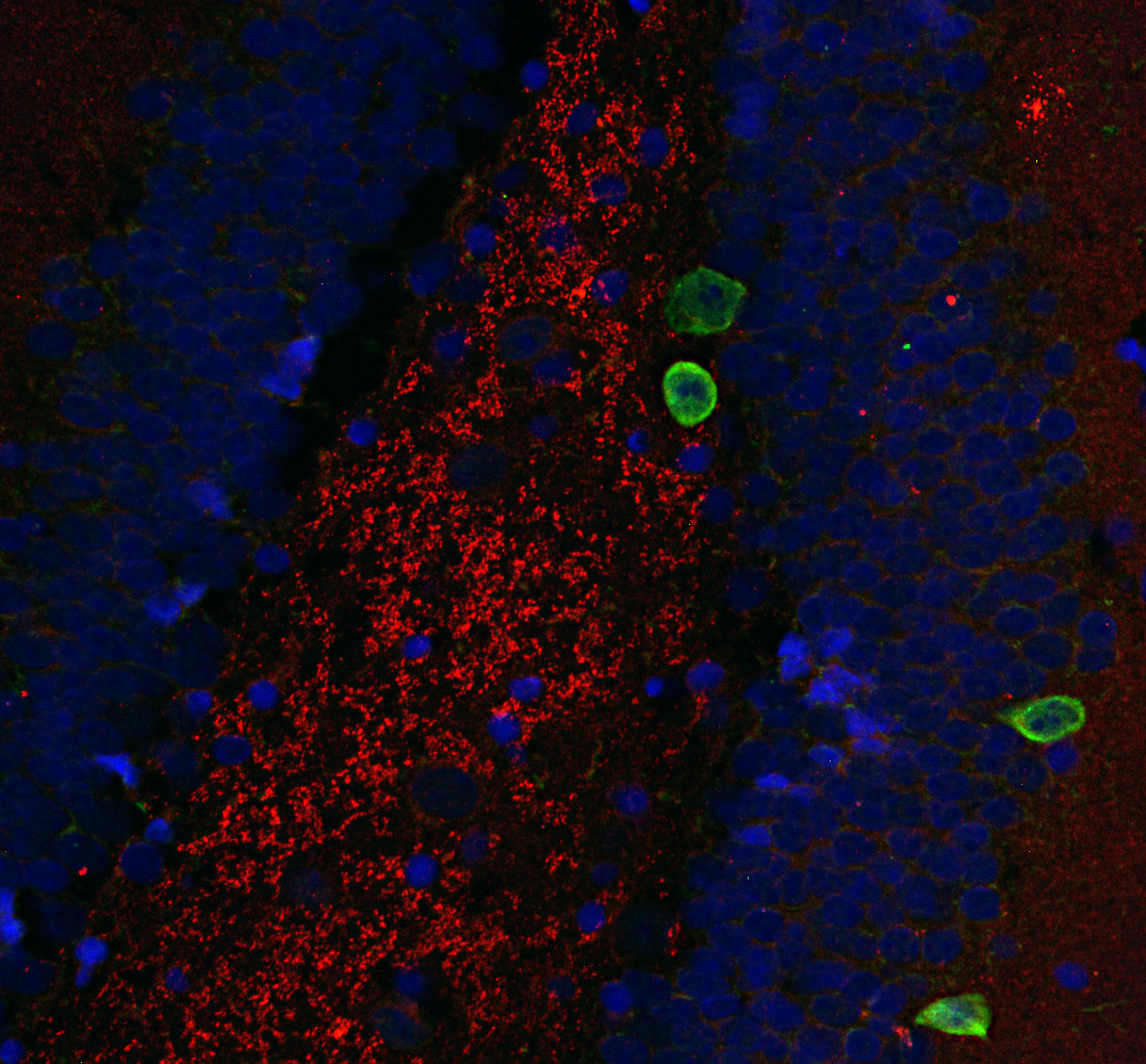Parvalbumin, Polyclonal rabbit antiserum