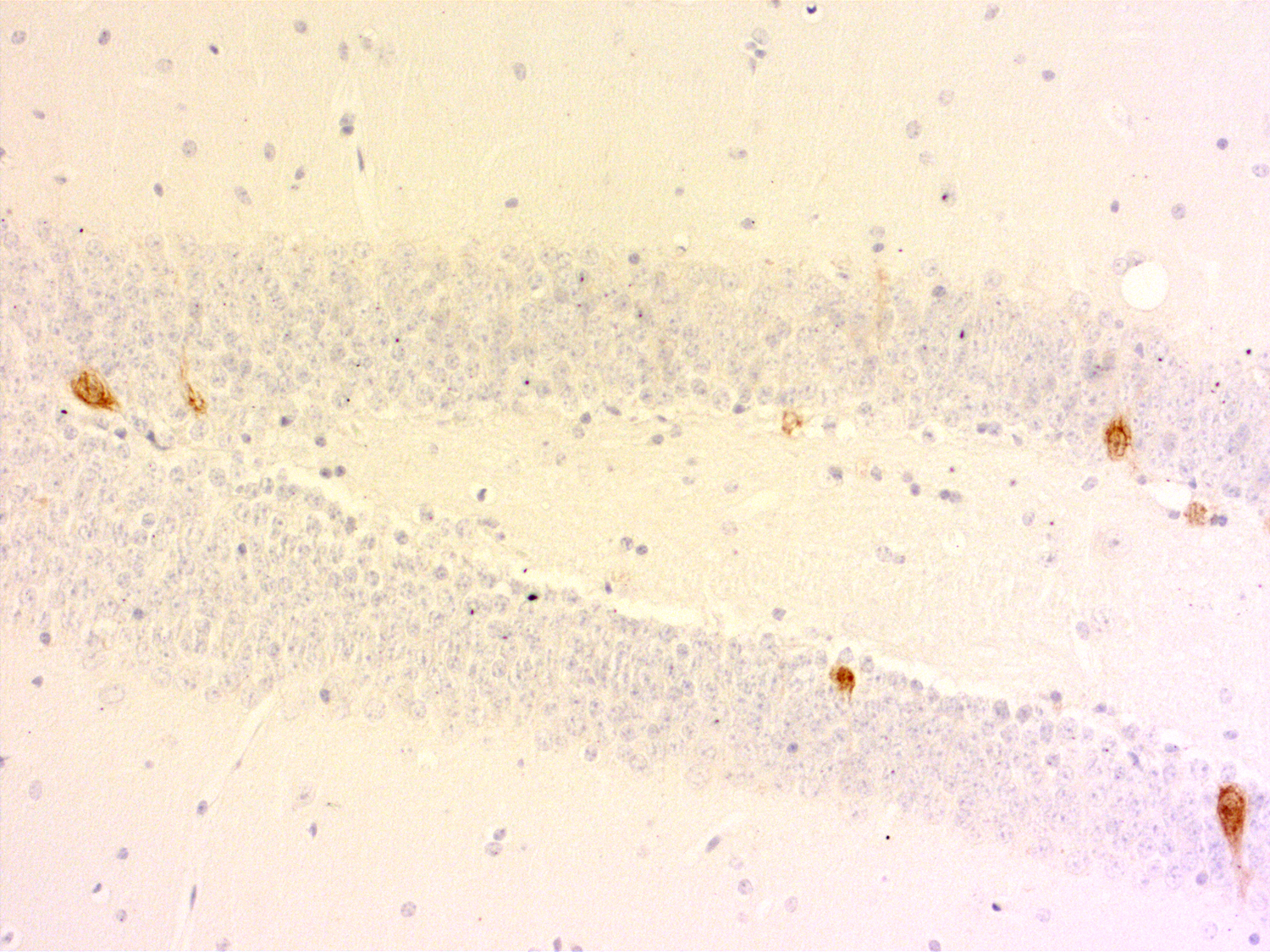 Parvalbumin, Recombinant rabbit