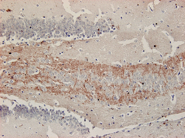 ZnT3, Polyclonal rabbit antiserum