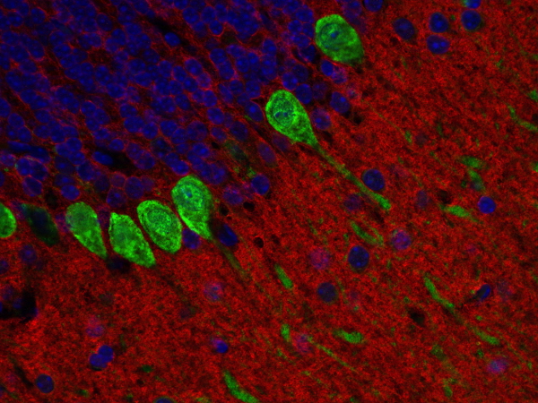 Calbindin D28k Polyclonal Guinea pig antiserum - image 4
