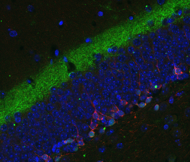 Calretinin Polyclonal Guinea pig antiserum - image 5