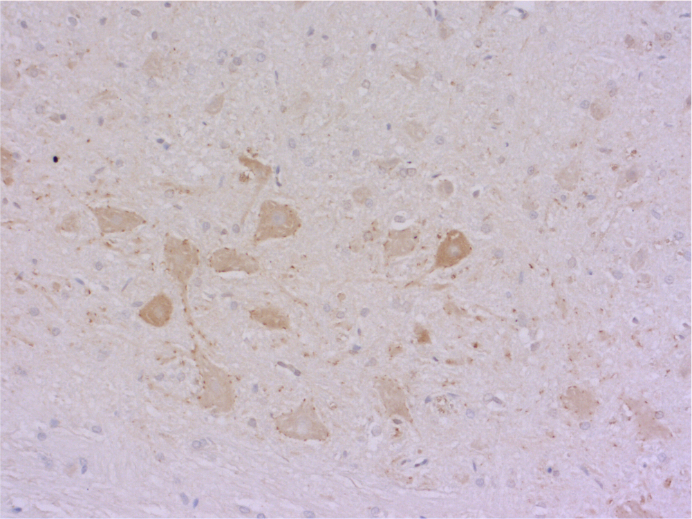 ChT, Polyclonal Guinea pig antiserum