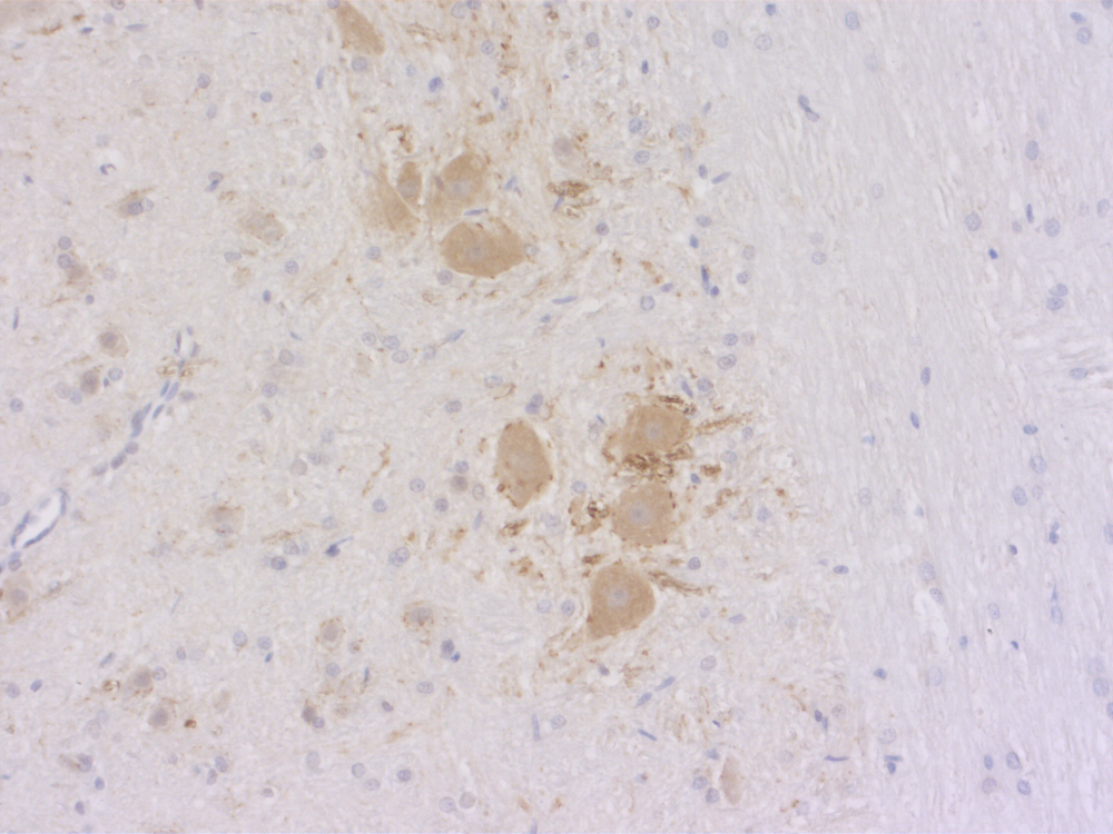 ChT, Polyclonal Guinea pig antiserum