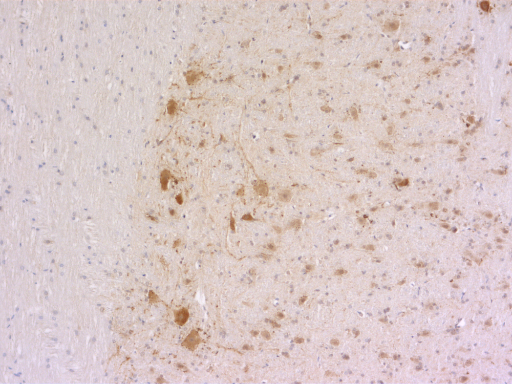 ChT, Polyclonal Guinea pig antiserum