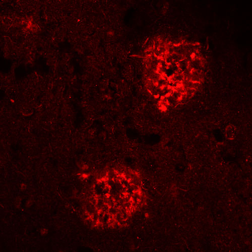 Abeta40 Polyclonal rabbit antiserum - image 2