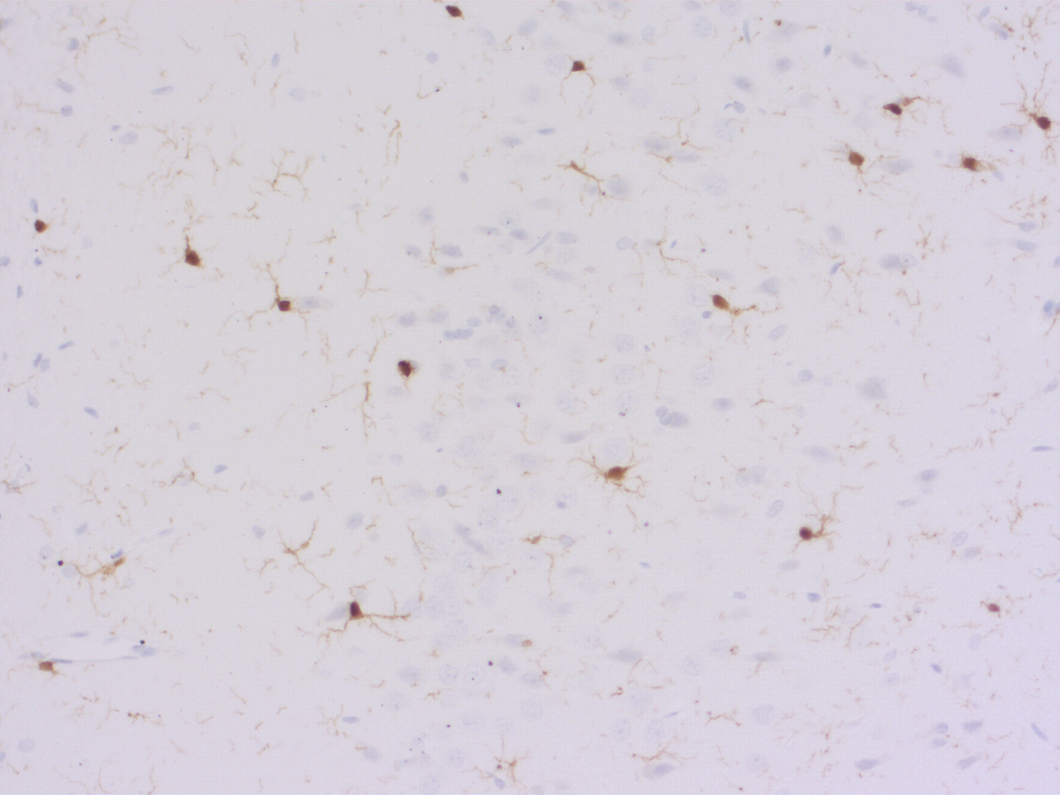IBA1 Recombinant chicken - image 5