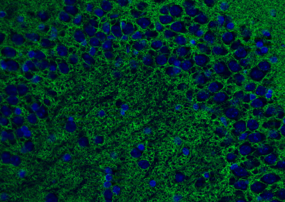 EAAT1 Polyclonal Guinea pig antiserum - image 4