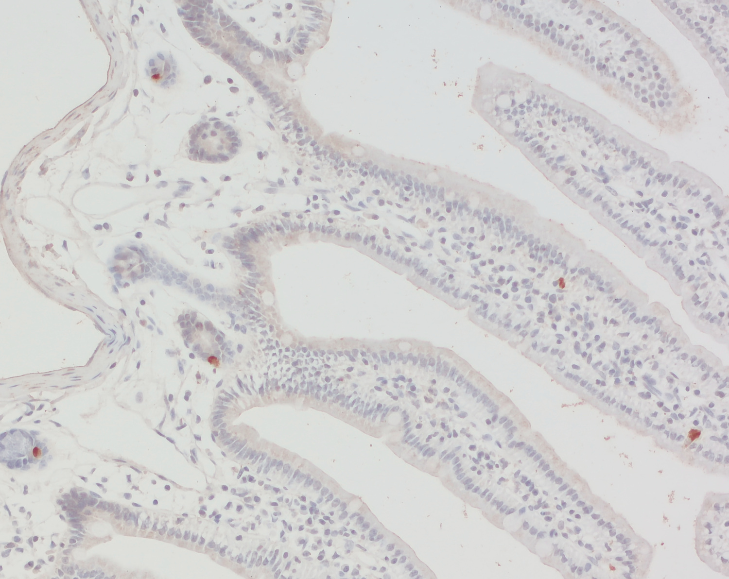 EAAT5, Polyclonal Guinea pig antiserum