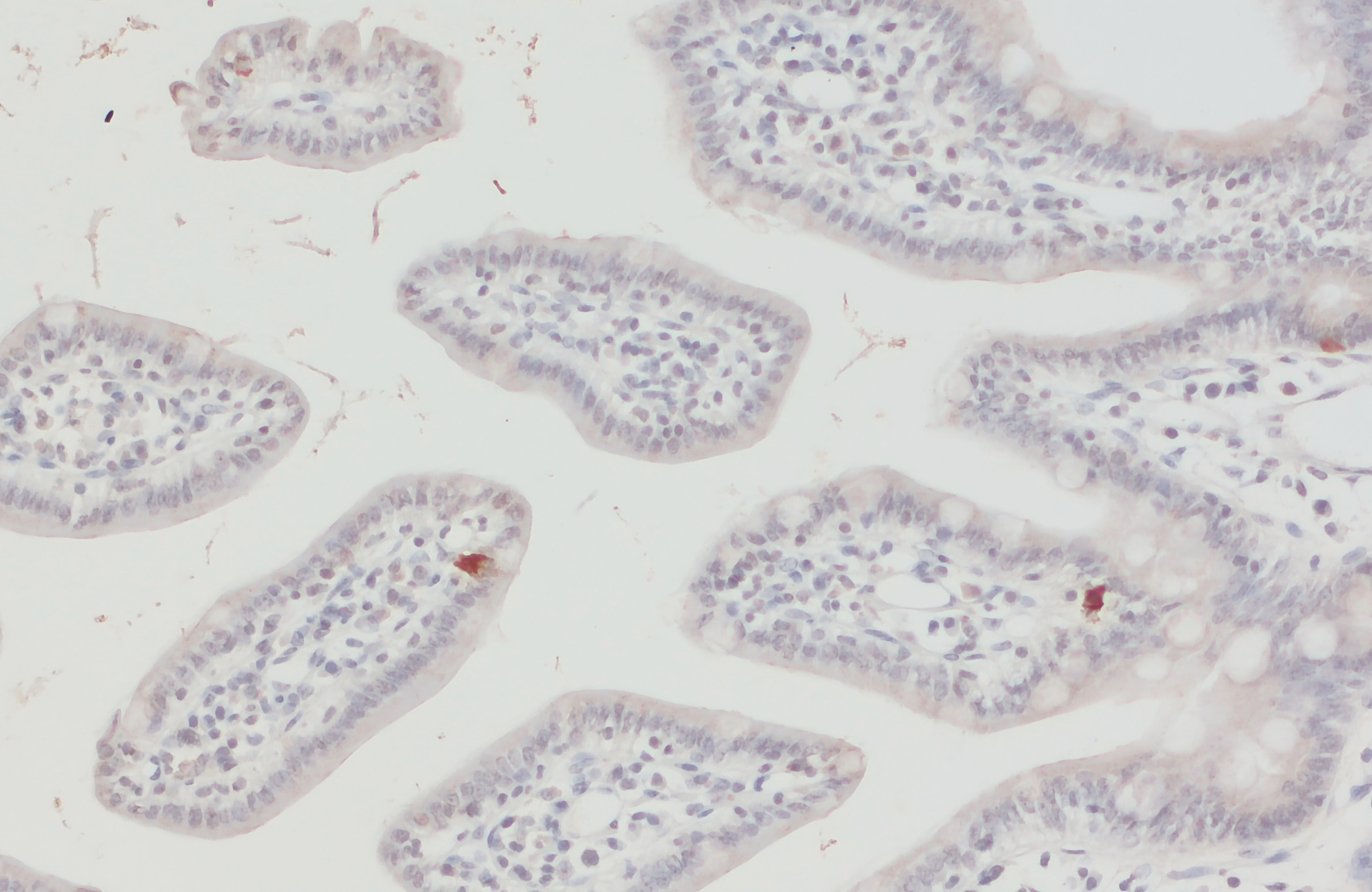 EAAT5, Polyclonal Guinea pig antiserum