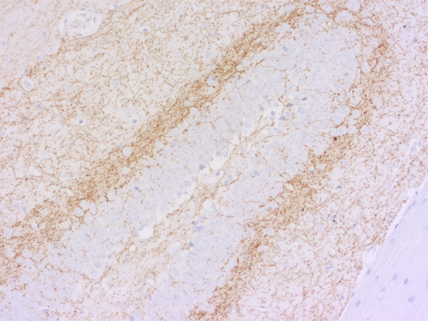 Cannabinoid receptor CB1-R Recombinant rabbit - image 4