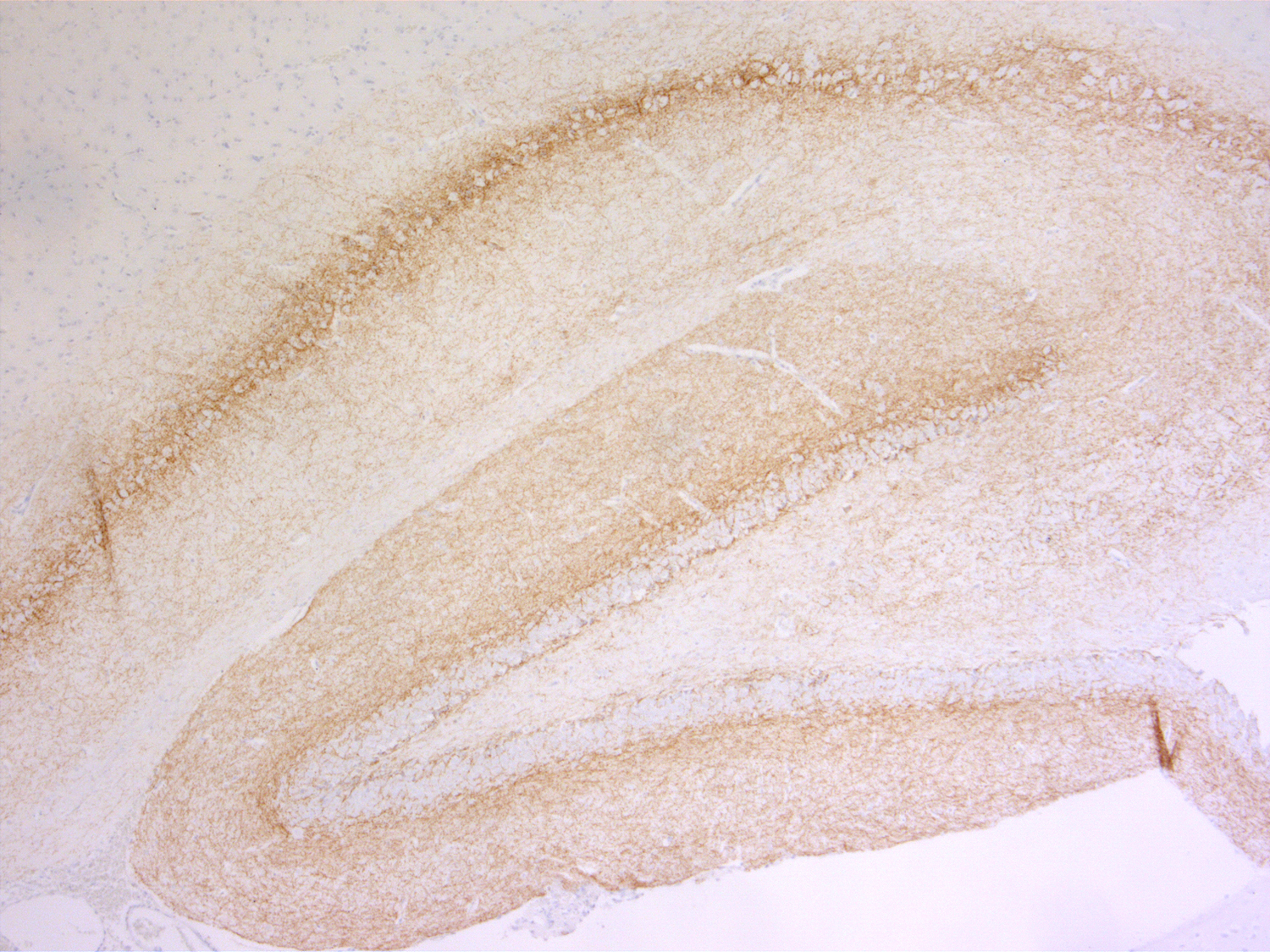 Cannabinoid receptor CB1-R Recombinant rabbit - image 5