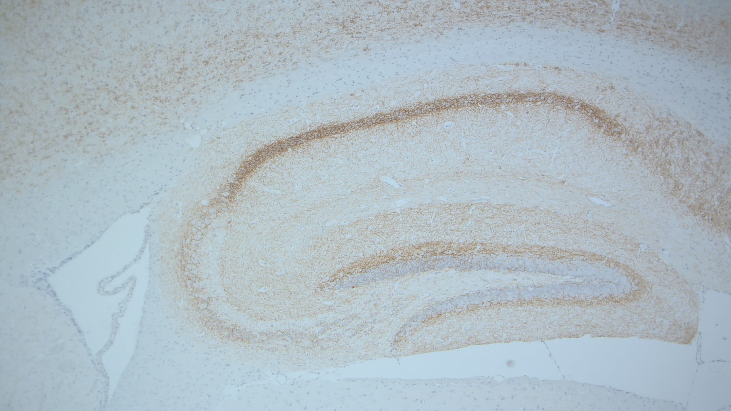 Cannabinoid receptor CB1-R Recombinant chicken - image 3