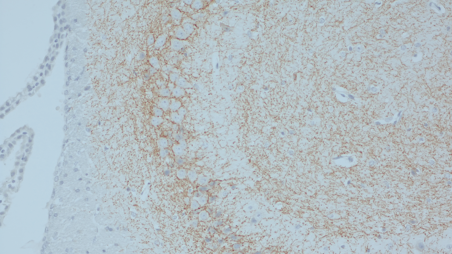 Cannabinoid receptor CB1-R Recombinant chicken - image 4