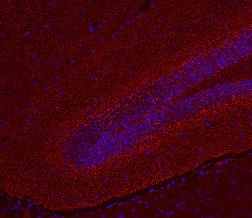 Cannabinoid receptor CB1-R Polyclonal Guinea pig antiserum - image 3