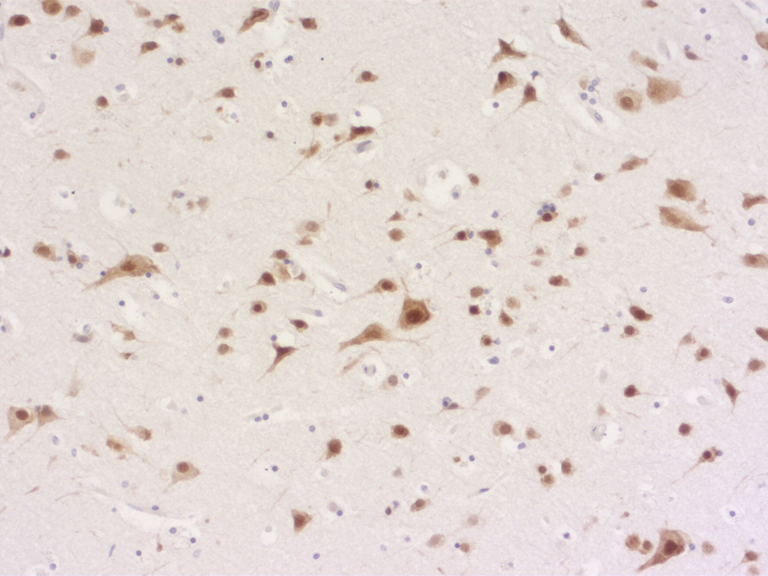 NeuN, Polyclonal Guinea pig antiserum