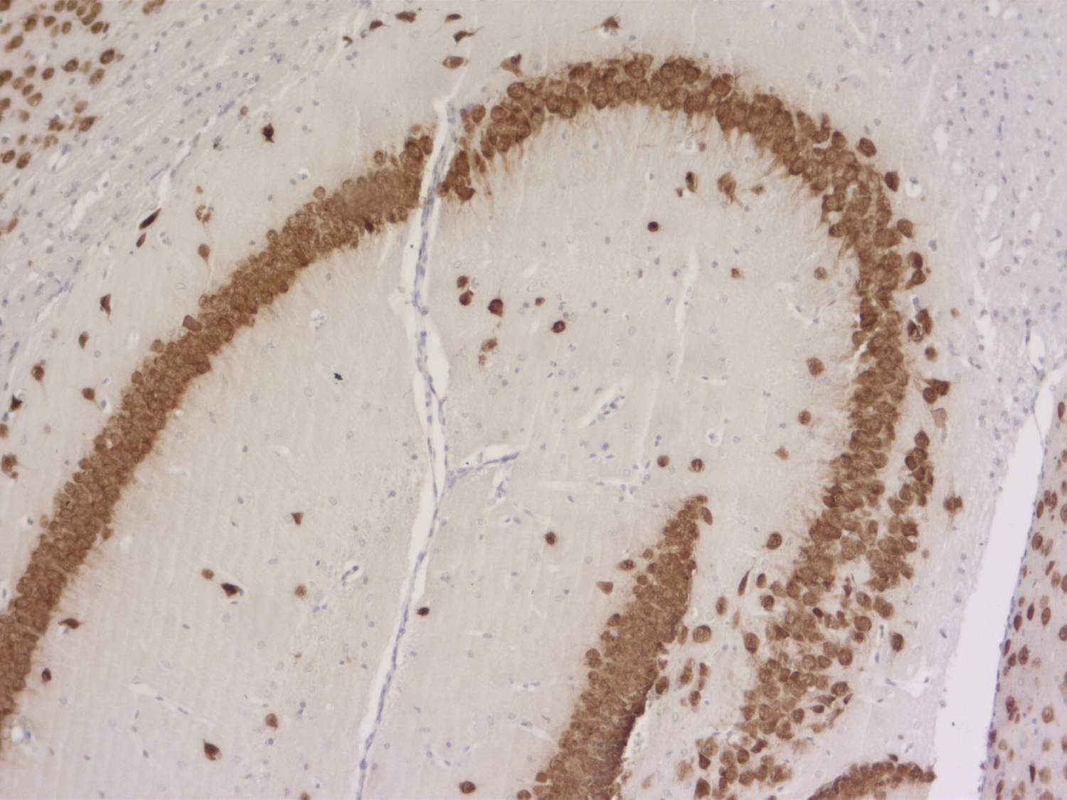 NeuN, Polyclonal Guinea pig antiserum