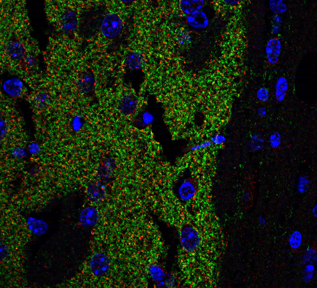 DAT, Polyclonal rabbit purified antibody