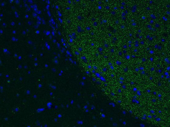DAT Polyclonal chicken purified antibody - image 3