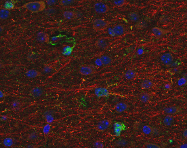S100B Polyclonal Guinea pig antiserum - image 3