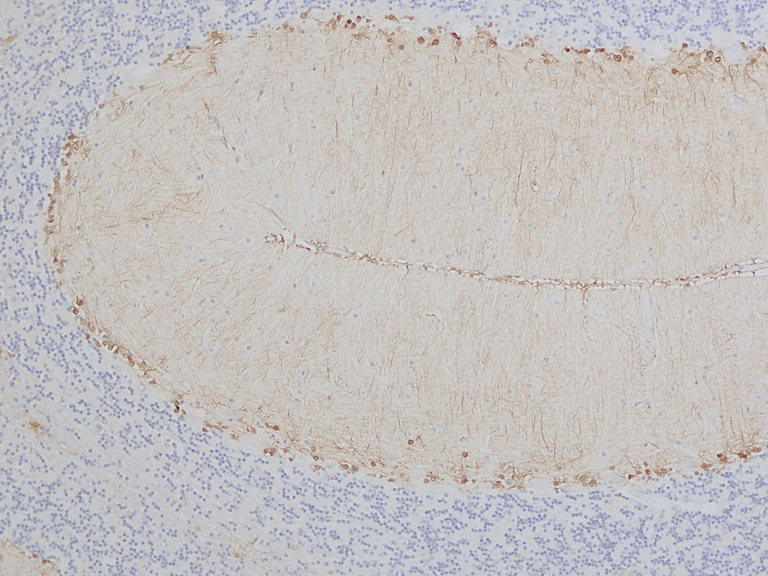 S100B, Recombinant rabbit