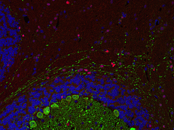 Olig2, Polyclonal rabbit purified antibody