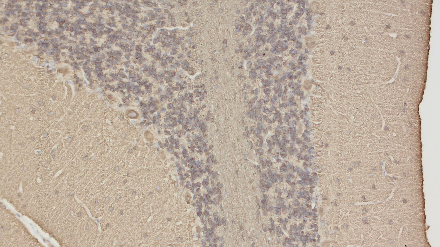 Glu-Tubulin Recombinant rabbit - image 5