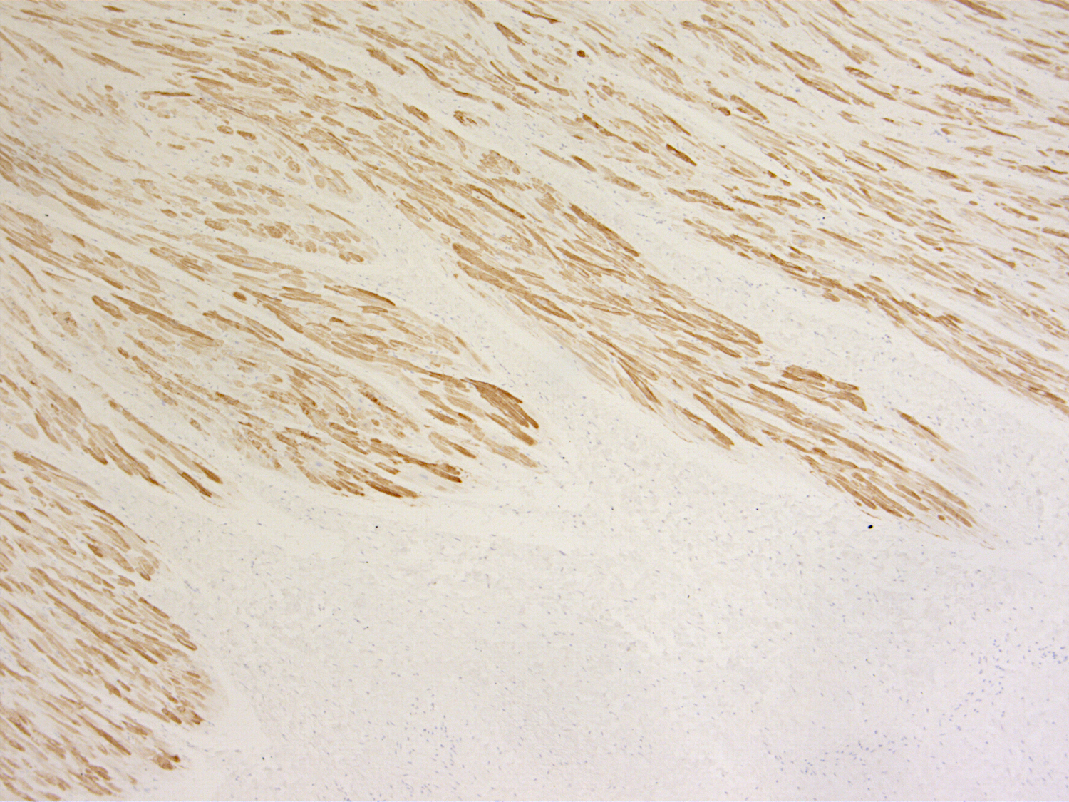 MLC-2V, Recombinant rabbit