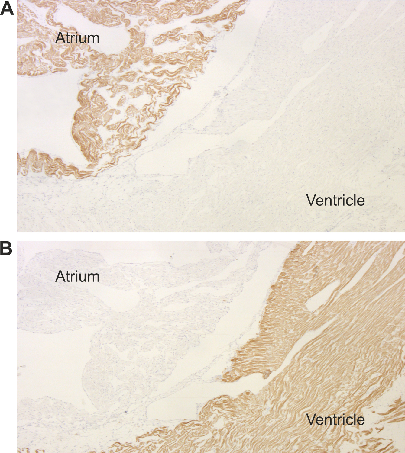 MLC-2V Recombinant rabbit - image 2