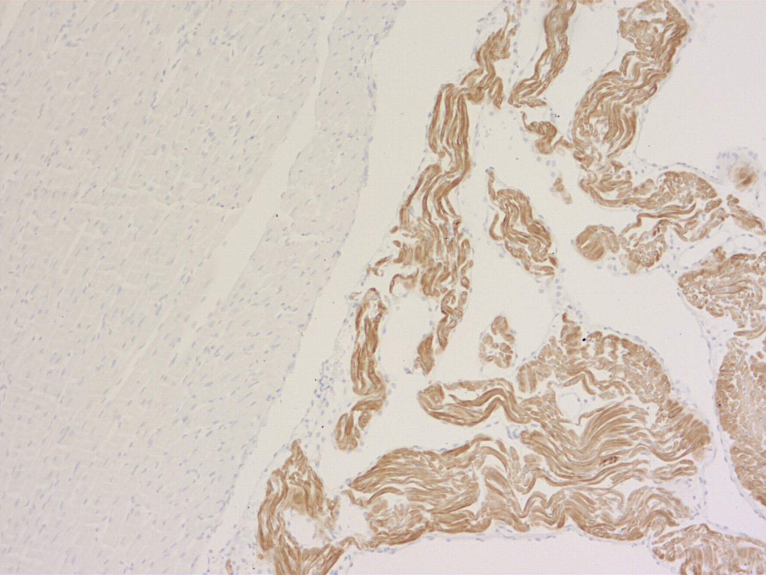 MLC-2A, Recombinant rabbit