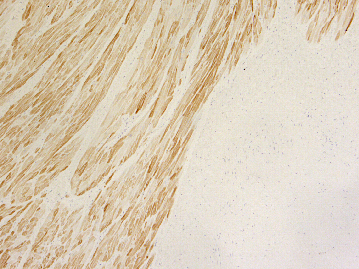 MLC-2A, Recombinant rabbit