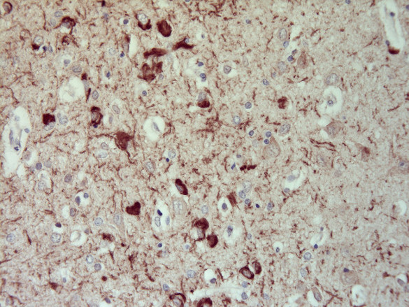 Tau, Polyclonal rabbit antiserum