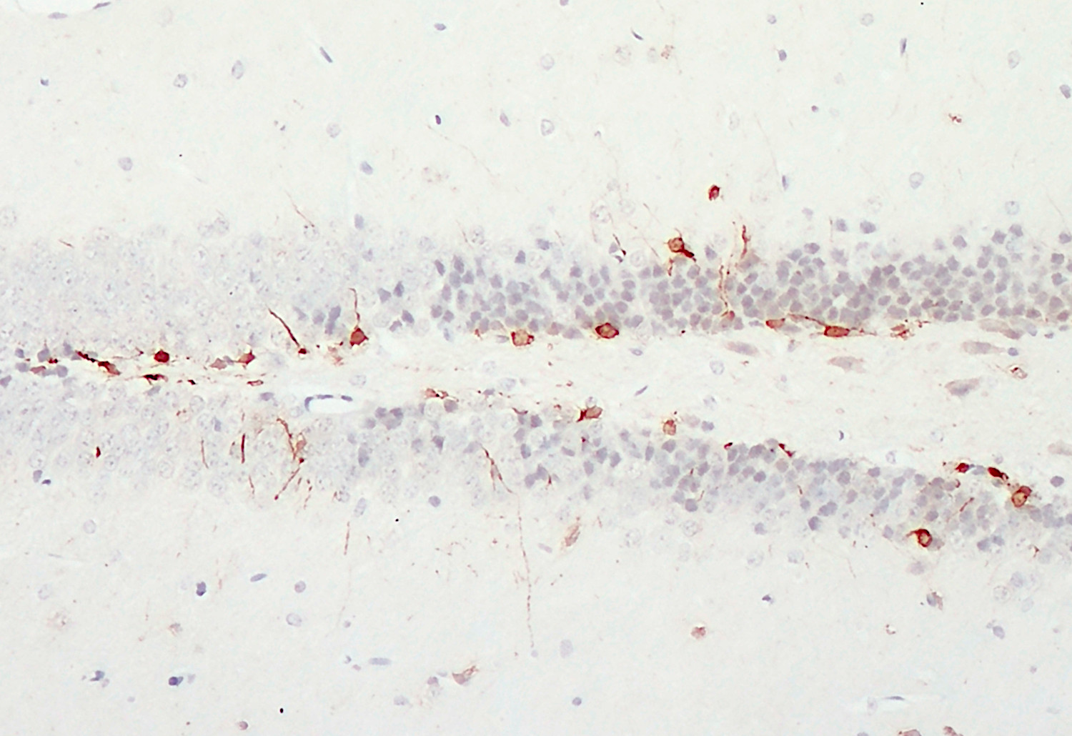 Doublecortin, Polyclonal Guinea pig antiserum