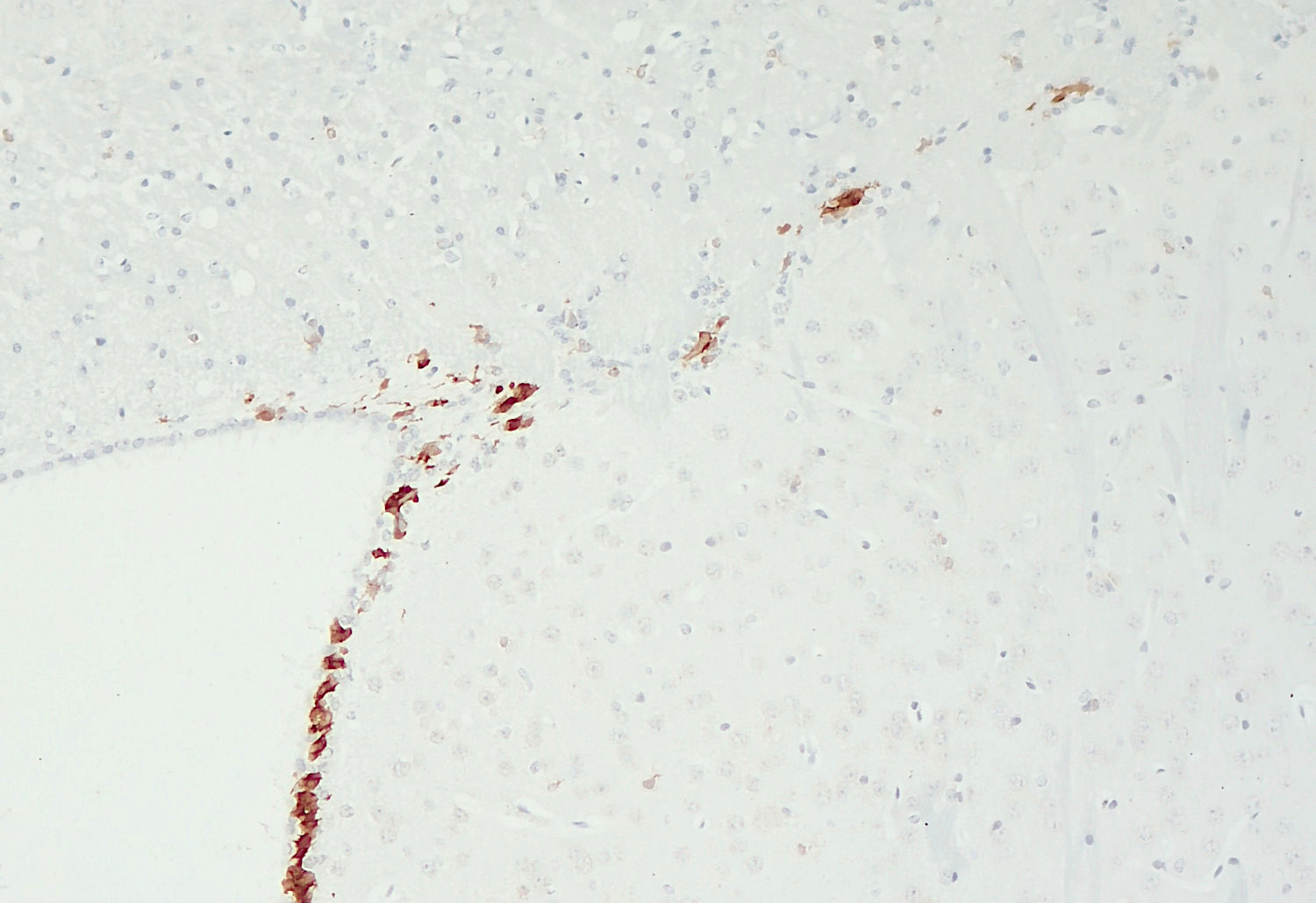Doublecortin, Polyclonal Guinea pig antiserum
