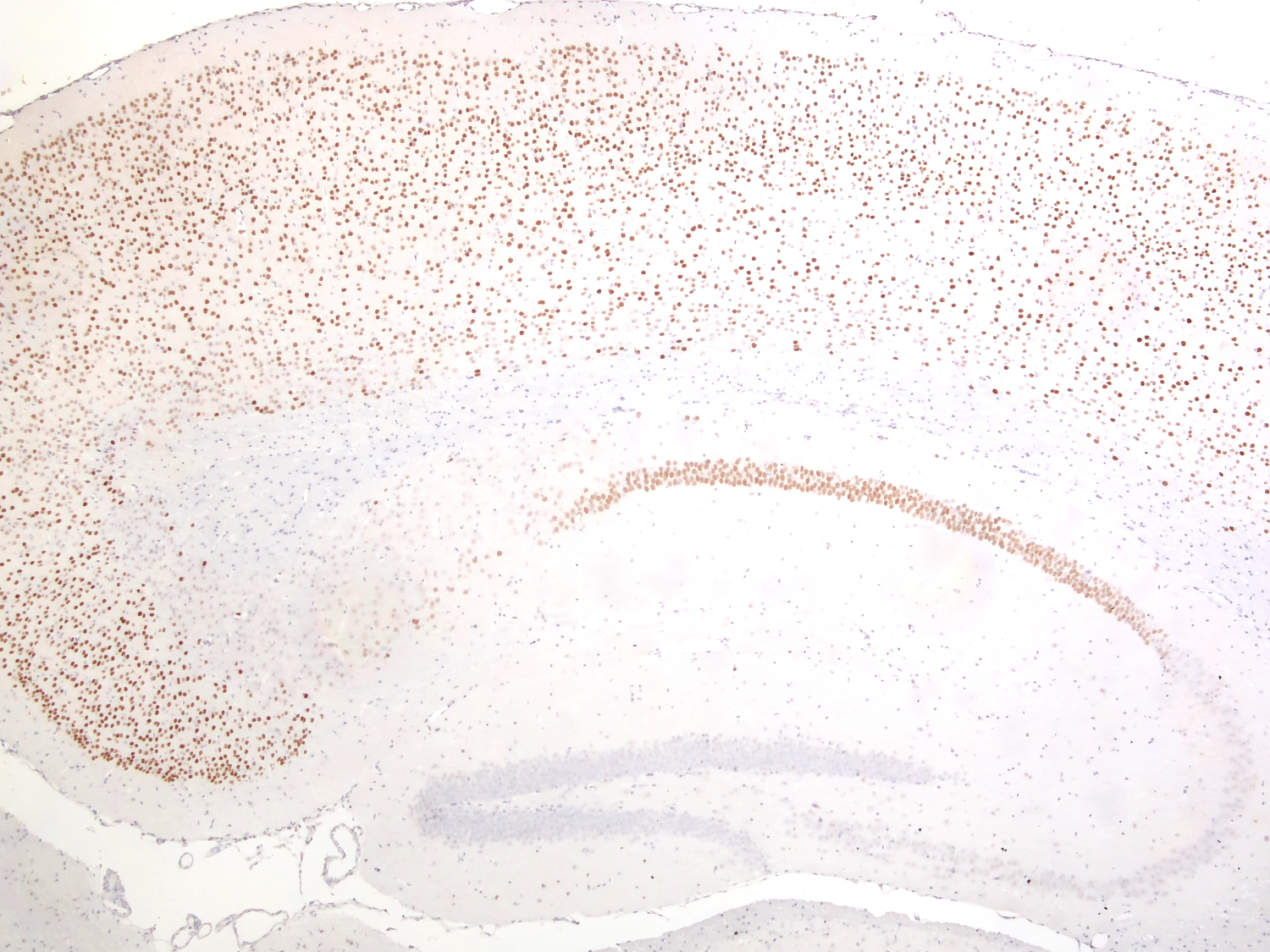SATB2, Polyclonal Guinea pig antiserum