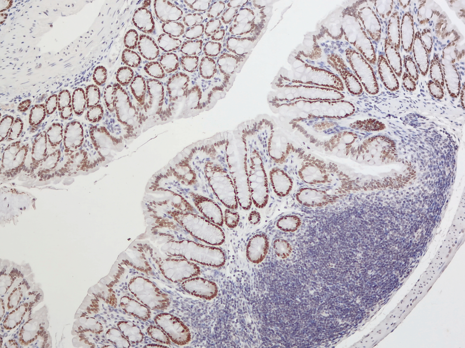 SATB2, Polyclonal Guinea pig antiserum