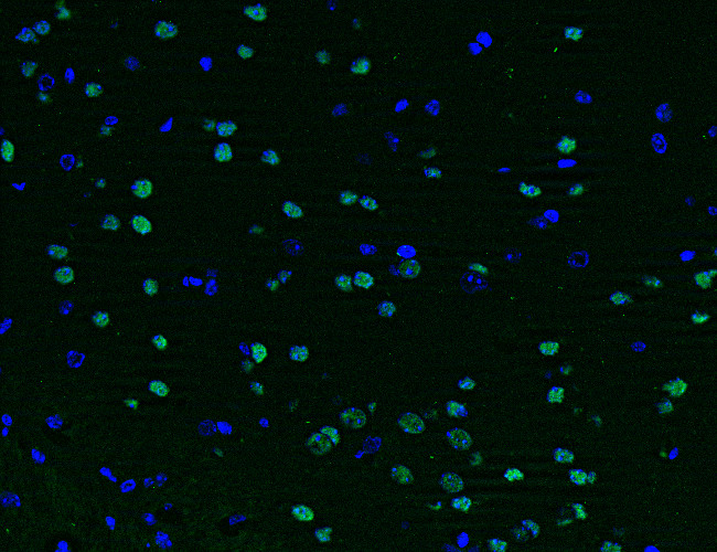 SATB2, Polyclonal Guinea pig antiserum