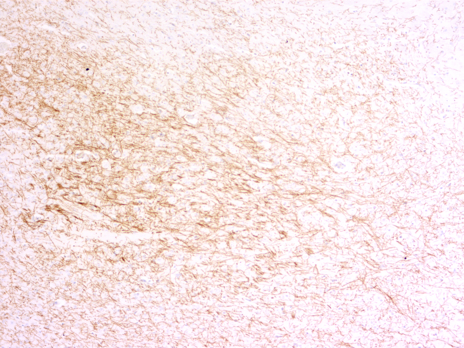 SERT, Recombinant rabbit