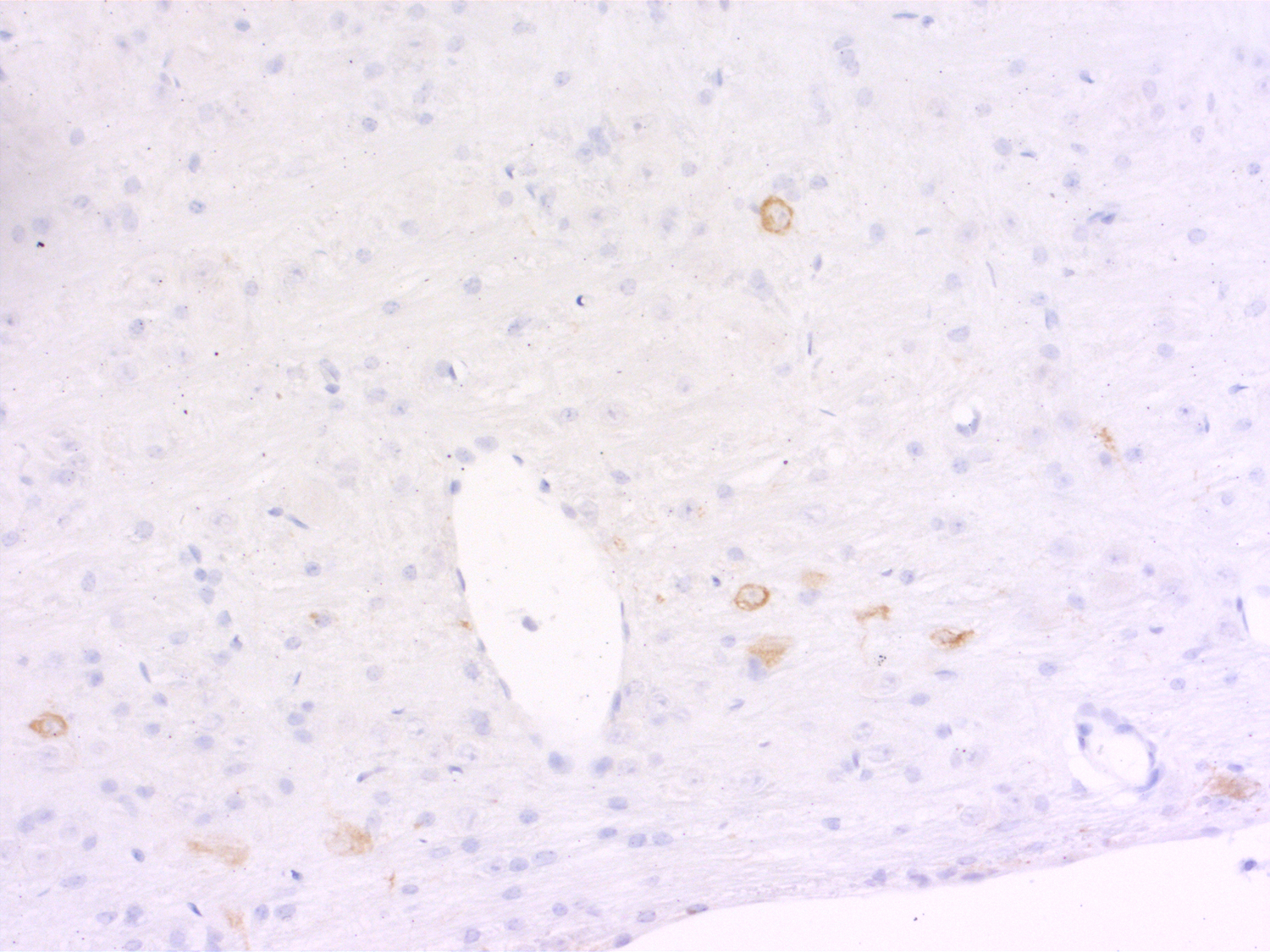 Tryptophan hydroxylase2 Recombinant rabbit - image 3