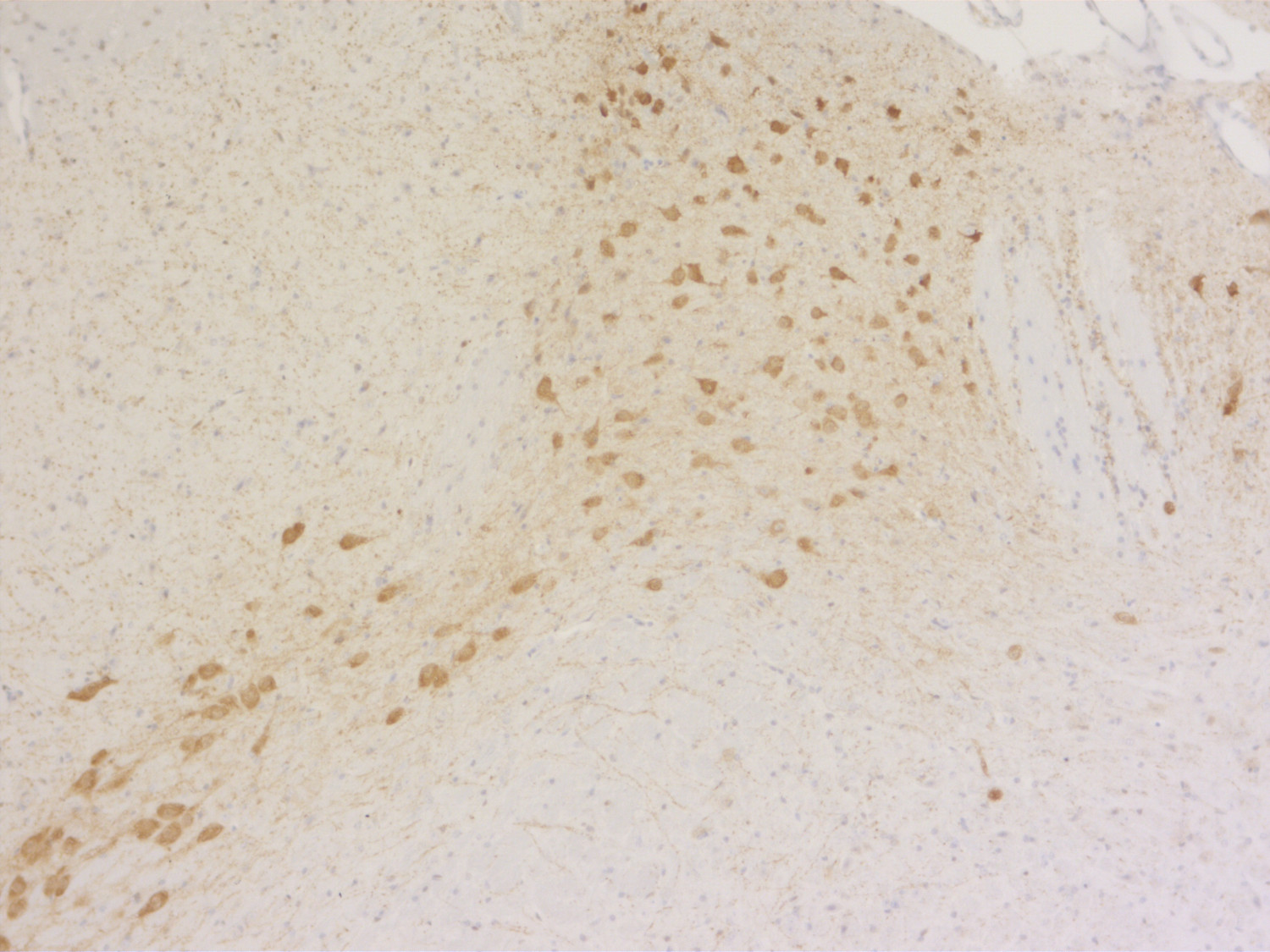 DOPA decarboxylase, Polyclonal Guinea pig antiserum