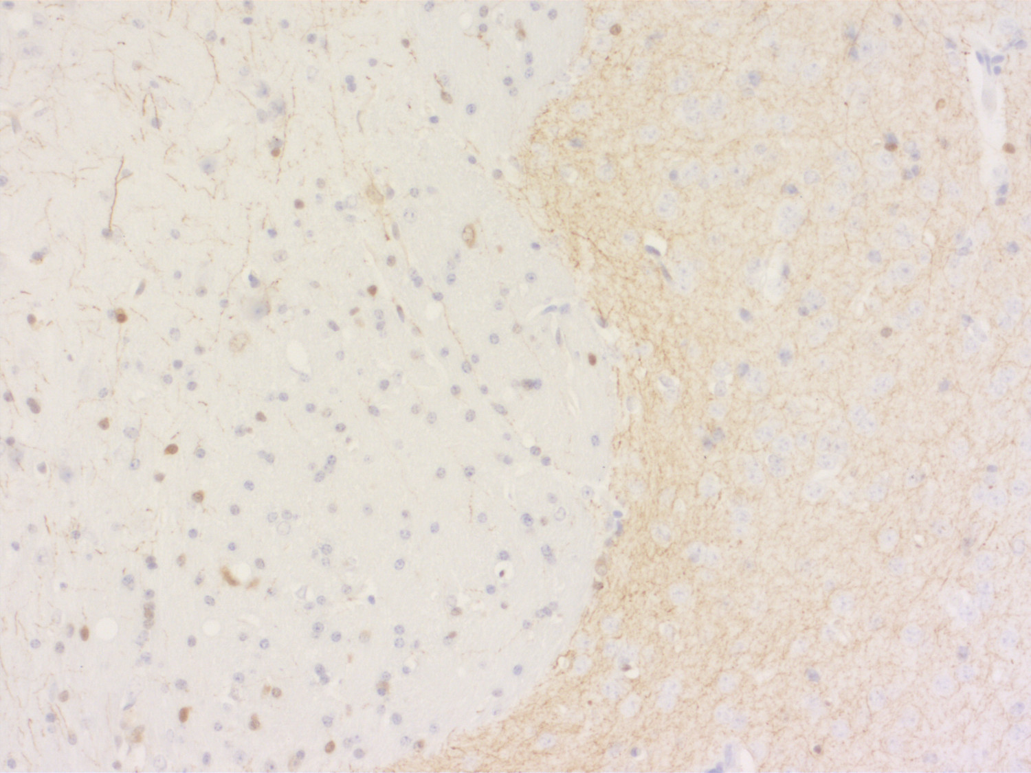DOPA decarboxylase, Polyclonal Guinea pig antiserum