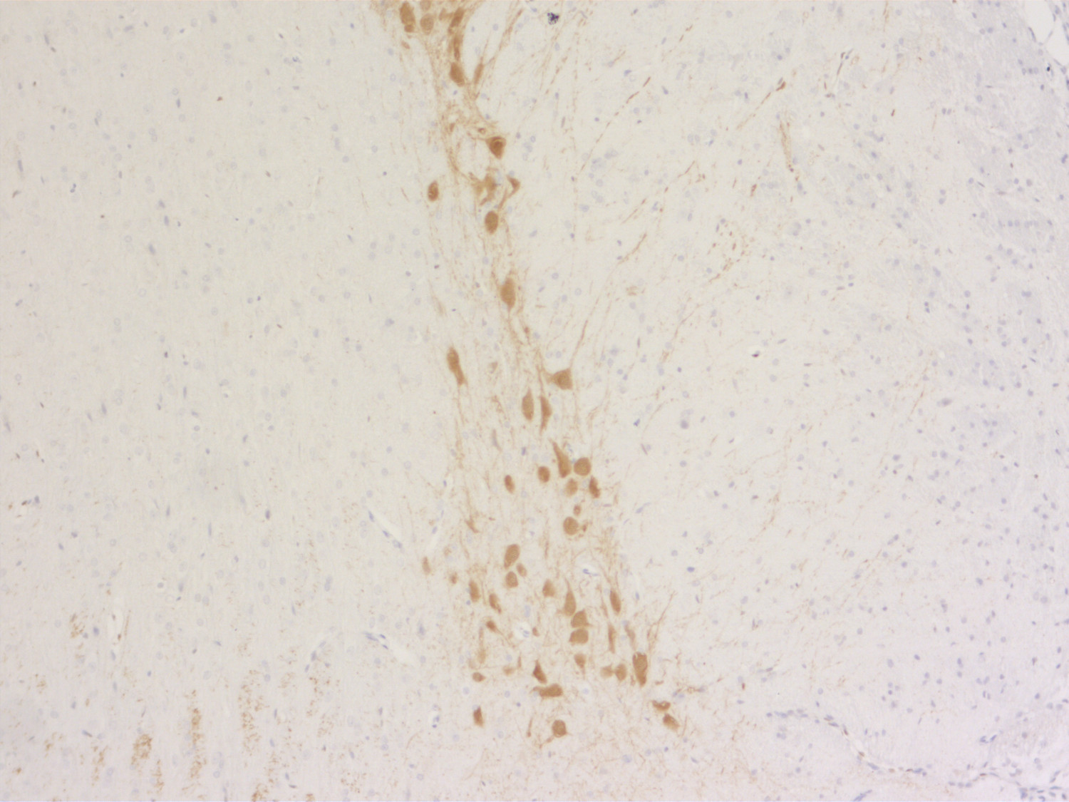 DOPA decarboxylase, Polyclonal Guinea pig antiserum