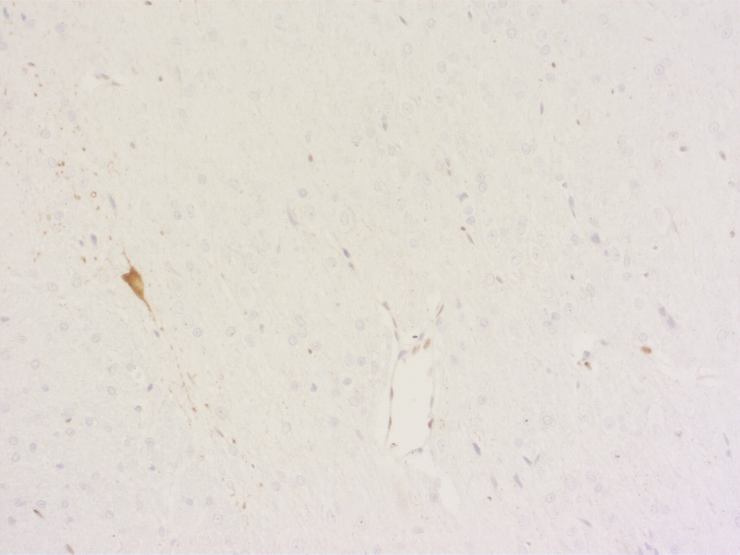 DOPA decarboxylase, Polyclonal Guinea pig antiserum