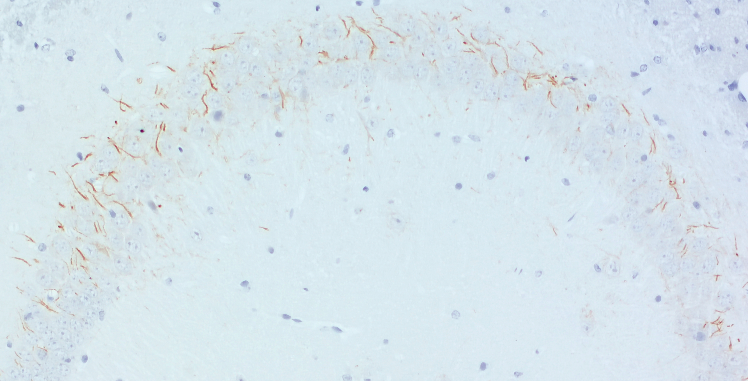 TRIM46 Recombinant chicken - image 4