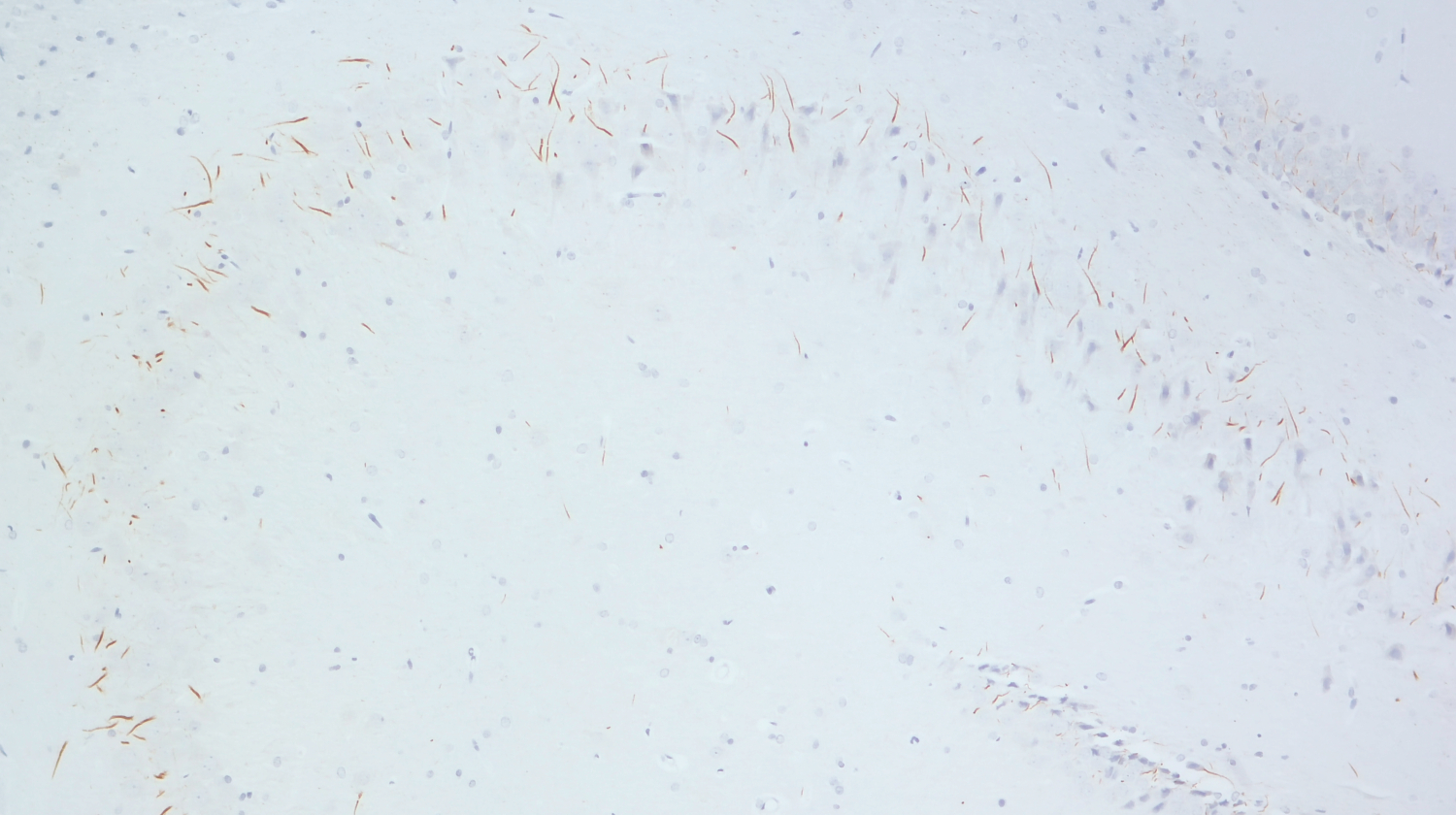 TRIM46 Recombinant chicken - image 5