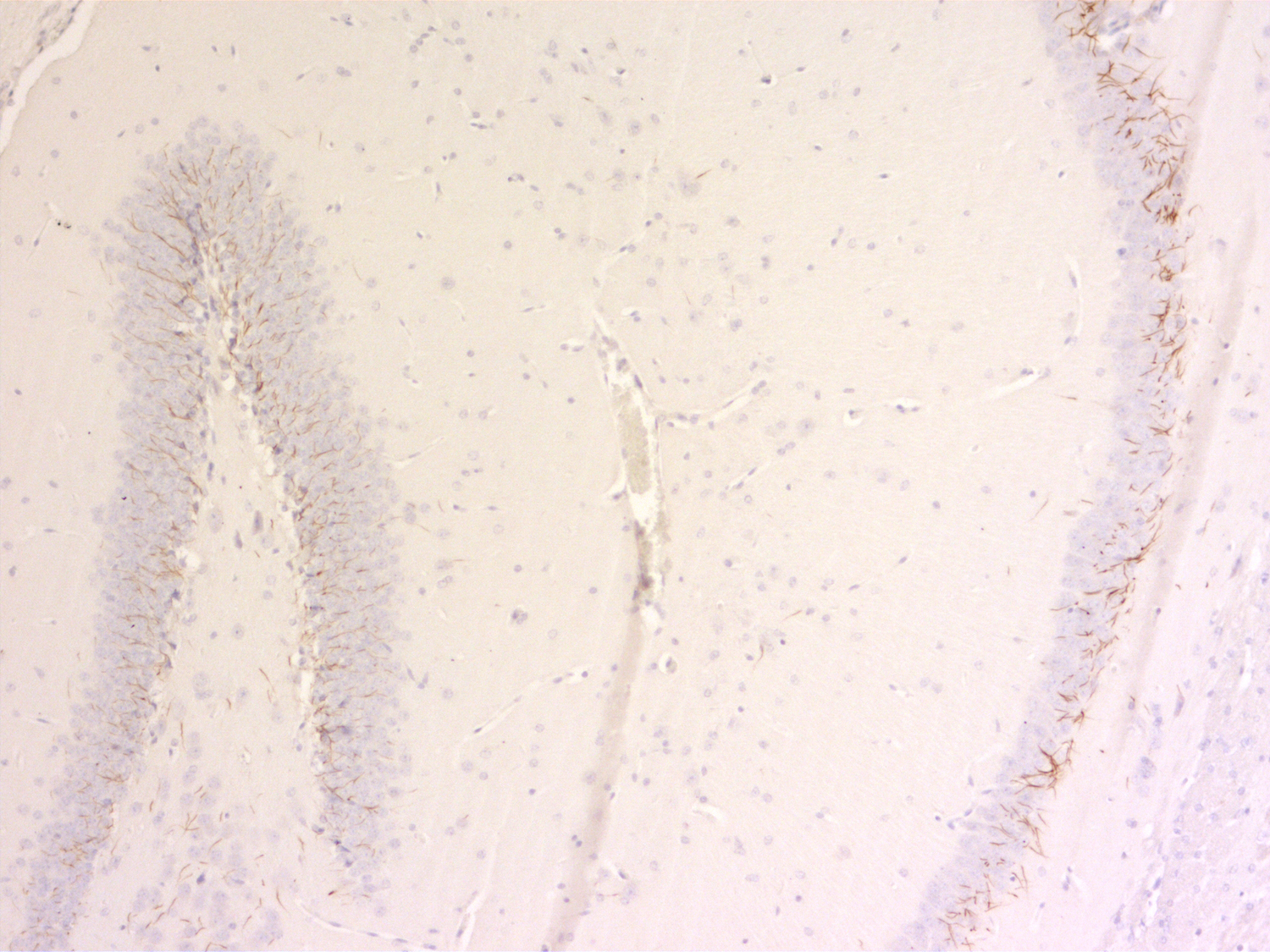 TRIM46 Recombinant Guinea pig - image 5