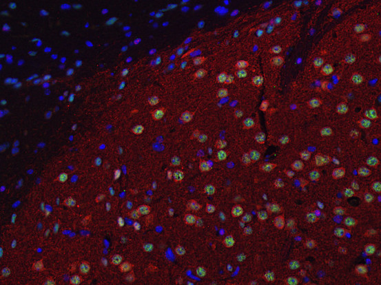 DARPP32, Polyclonal rabbit antiserum