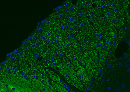 DARPP32, Polyclonal Guinea pig antiserum