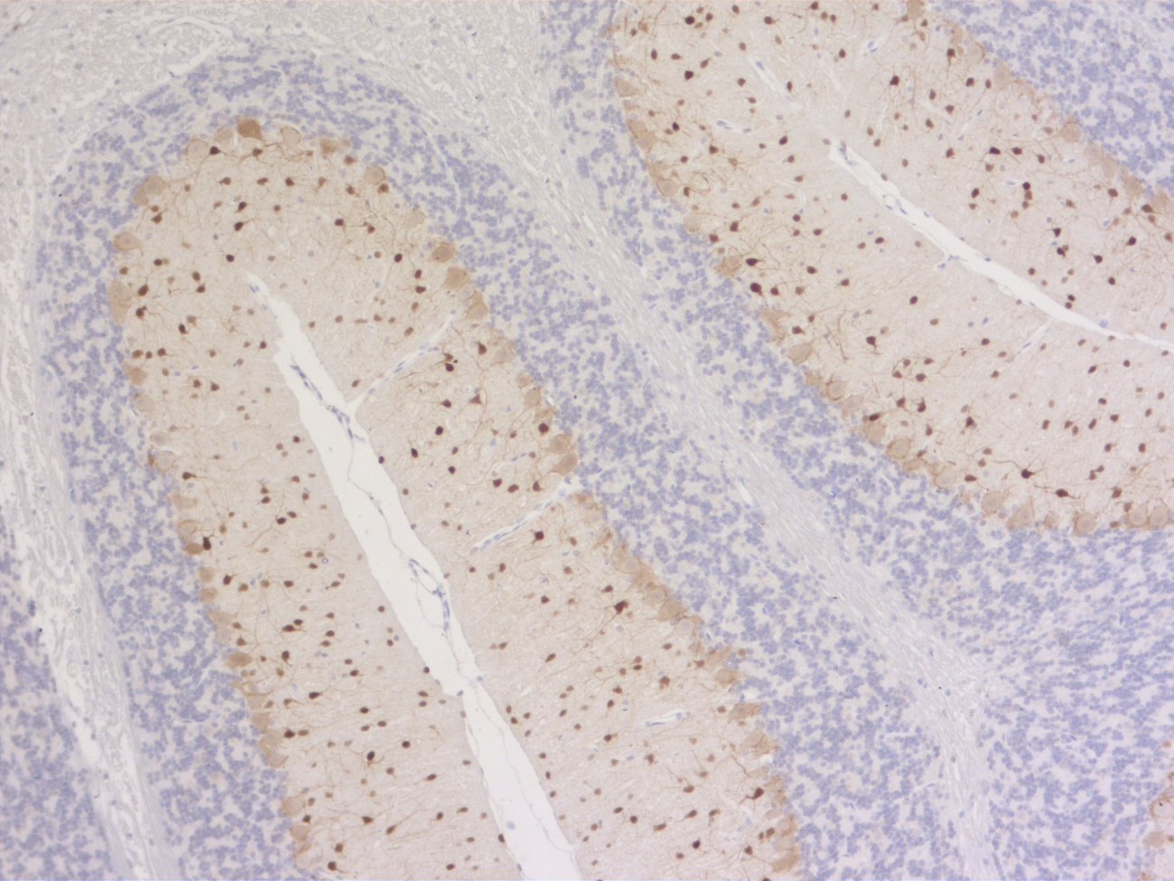 RFP, Polyclonal Guinea pig antiserum